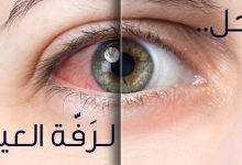 صورة سبب رفة العين اليسرى في الإسلام