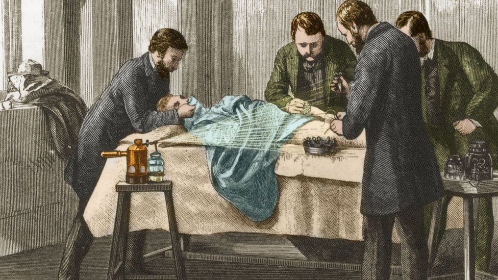 صورة الطبيب والجراح الانجليزي الذي عرف العلاقة بين معدل الوفيات ودرجة التعقيم في أثناء العمليات الجراحية في القرن الثامن عشر هو جوزيف ليستر