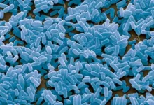 صورة البكتيريا الموجبة والسالبة لصبغة جرام