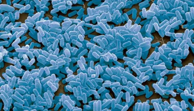 انواع البكتيريا الموجبة والسالبة لصبغة جرام1 800x447 1