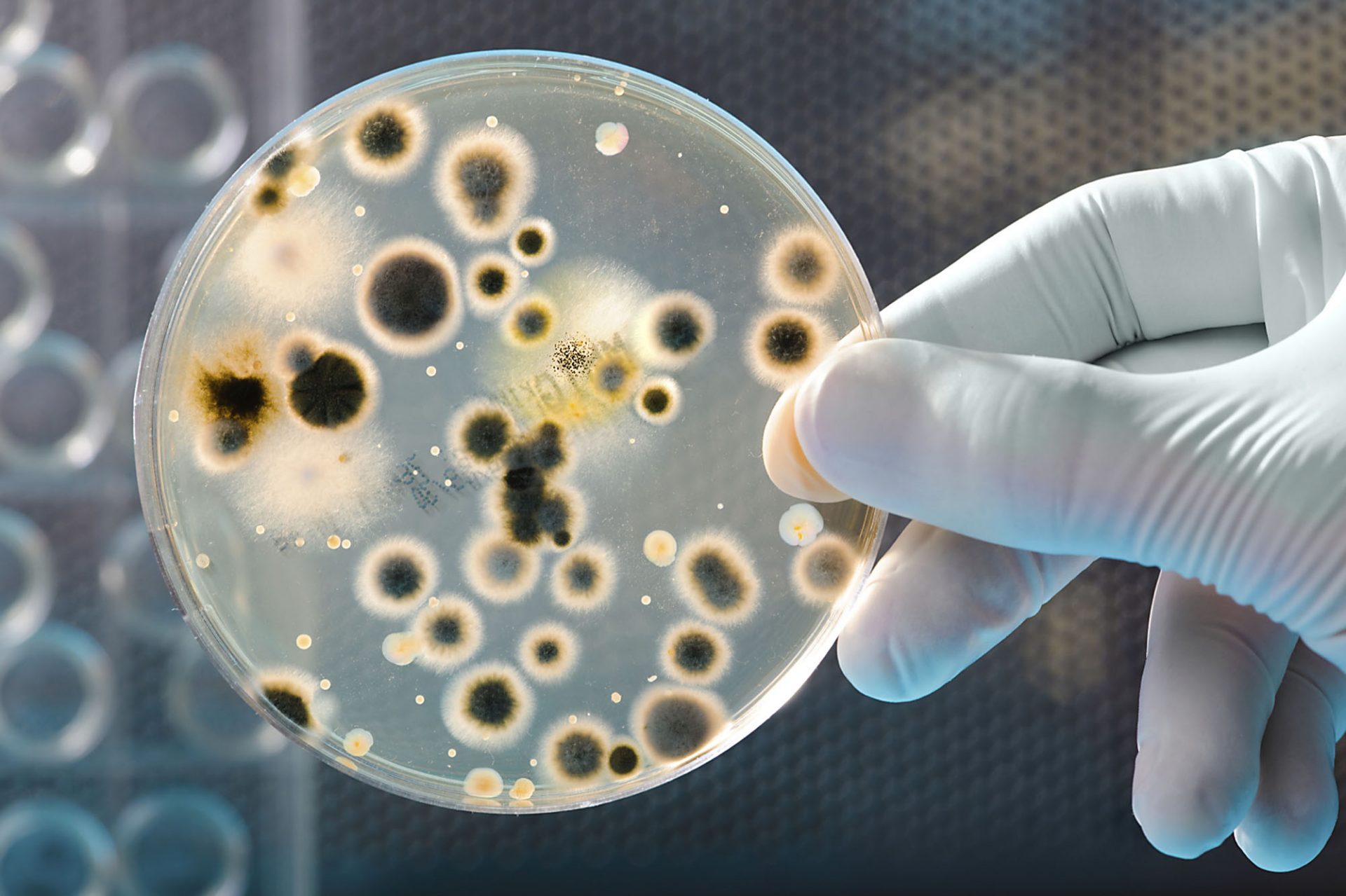 صورة تنتج بكتيريا أشير شيا كولاي في امعاء الانسان