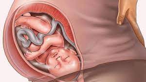 صورة طريقة استخدام حبوب سايتوتك للاجهاض في الشهر الأول