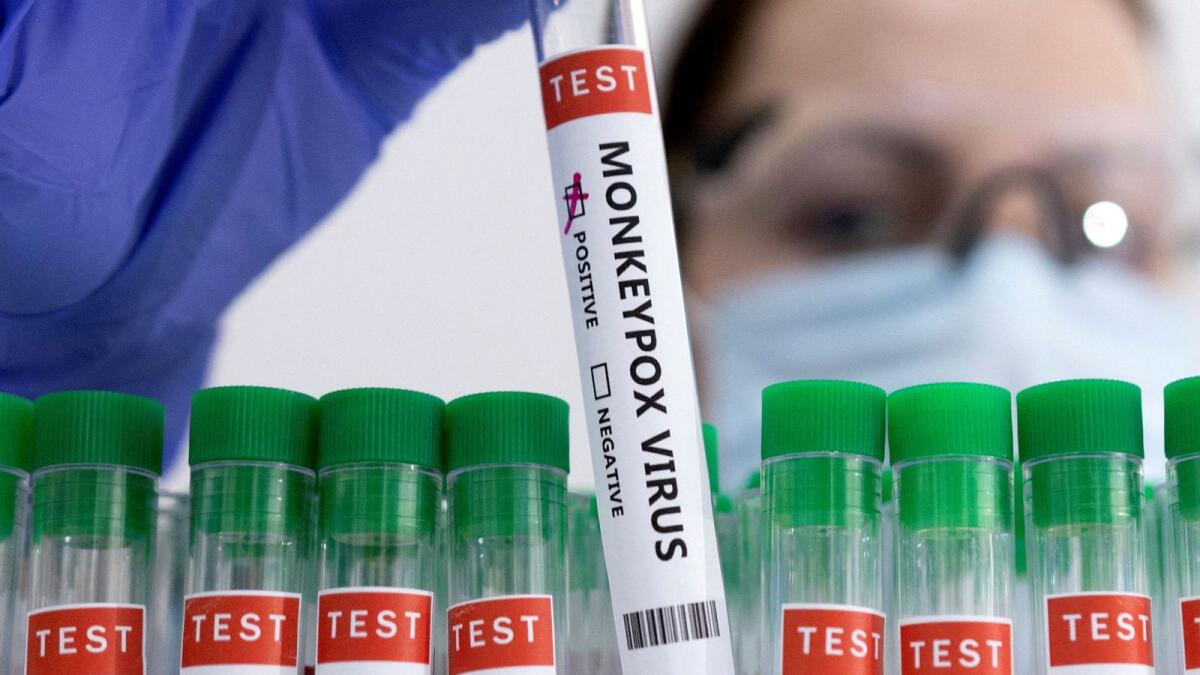 صورة رابط تسجيل تطعيم جدري القرود البحرين عبر موقع وزارة الصحة