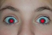 صورة سبب العيون الحمراء التي تظهر في صور الأشخاص هو